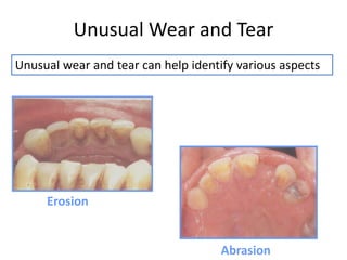 Unusual Wear and Tear
Erosion
Abrasion
Unusual wear and tear can help identify various aspects
 