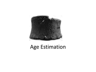 Age Estimation
 