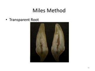 • Transparent Root
56
Miles Method
 