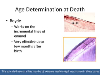 Age Determination at Death
• Boyde
– Works on the
incremental lines of
enamel
– Very effective upto
few months after
birth
This so-called neonatal line may be of extreme medico-legal importance in these cases
 