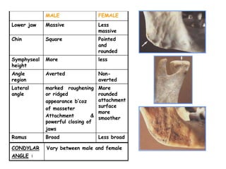 MALE FEMALE
Lower jaw Massive Less
massive
Chin Square Pointed
and
rounded
Symphyseal
height
More less
Angle
region
Averted Non-
averted
Lateral
angle
marked roughening
or ridged
appearance b’coz
of masseter
Attachment &
powerful closing of
jaws
More
rounded
attachment
surface
more
smoother
Ramus Broad Less broad
CONDYLAR
ANGLE :
Vary between male and female
 