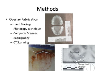 Methods
• Overlay Fabrication
– Hand Tracings
– Photocopy technique
– Computer Scanner
– Radiography
– CT Scanning
 