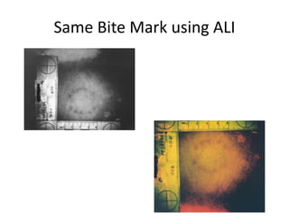 Same Bite Mark using ALI
 