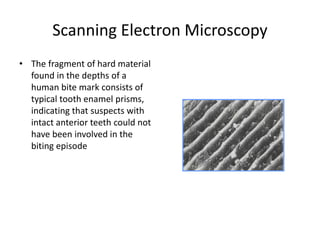 Scanning Electron Microscopy
• The fragment of hard material
found in the depths of a
human bite mark consists of
typical tooth enamel prisms,
indicating that suspects with
intact anterior teeth could not
have been involved in the
biting episode
 