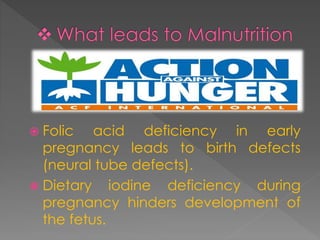 Malnutrition | PPTX