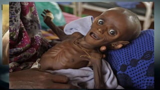 •3,900 childrendieeach day
due to dirty water or poor
hygiene.
Fact
 