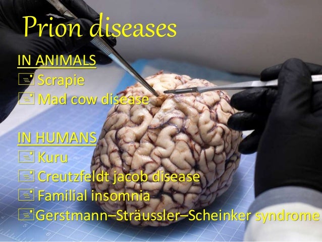 PRIONS THE CLINICAL CURIOSITY