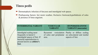 Interdigital Web Spcing final ppt quba presentation in dermatology department 28jan.pptx