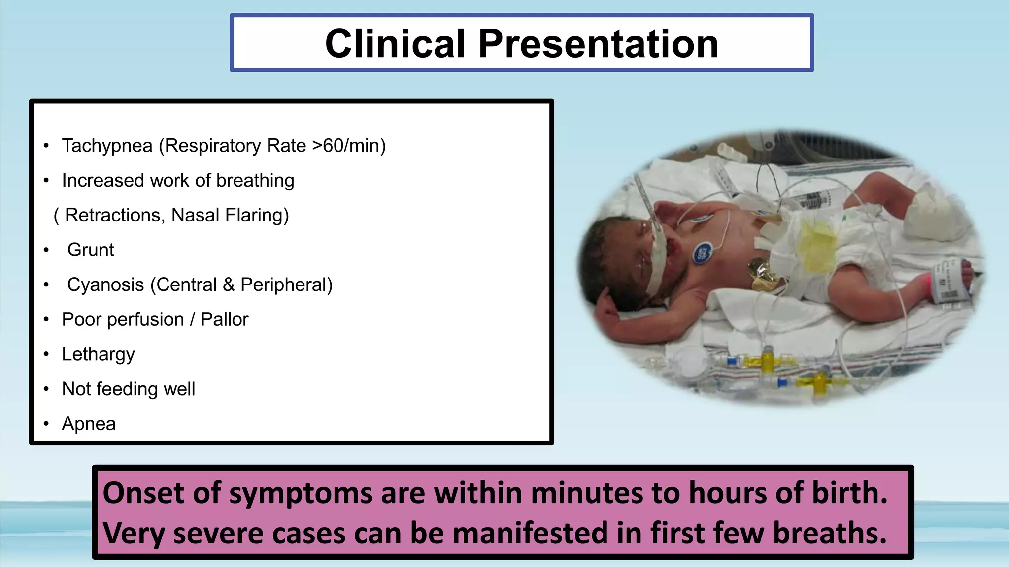 Respiratory physiology & Respiratory Distress syndrome in a newborn. | PPSX