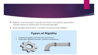 Understanding Spasticity and Rigidity: Neurophysiology, Clinical ...