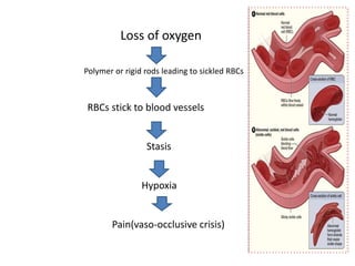 Loss of oxygen 
Polymer or rigid rods leading to sickled RBCs 
RBCs stick to blood vessels 
Stasis 
Hypoxia 
Pain(vaso-occlusive crisis) 
 