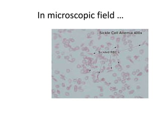 In microscopic field … 
 