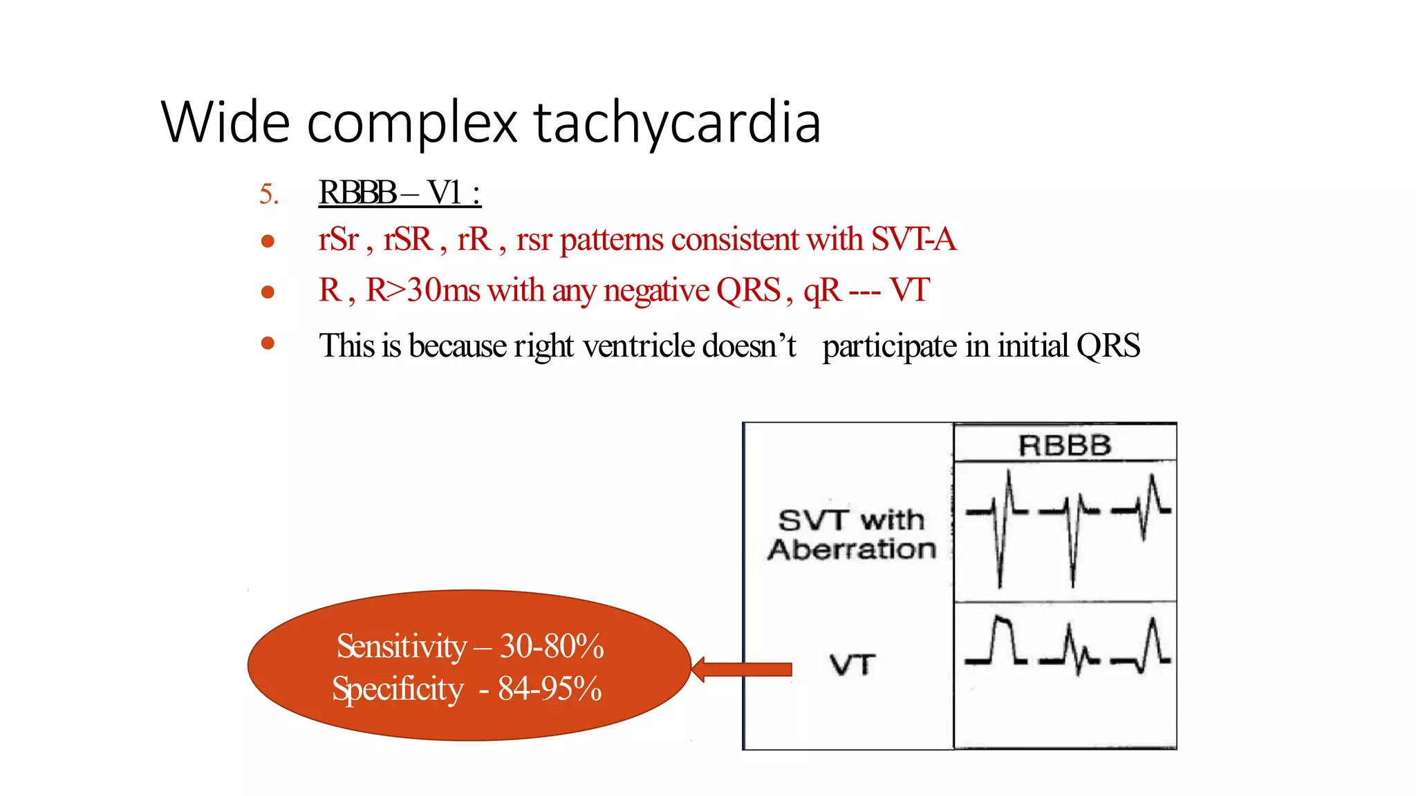 wide complex tachycardia.pptx