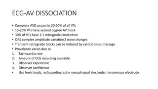 ECG-AV DISSOCIATION
• Complete AVD occurs in 20-50% of all VTs
• 15-20% VTs have second degree AV block
• 30% of VTs have 1:1 retrograde conduction
• QRS complex amplitude variation,T wave changes
• Transient retrograde blocks can be induced by carotid sinus massage
• Prevalence varies due to
1. Tachycardia rate
2. Amount of ECG recording available
3. Observer experience
4. Observer confidence
• Use lewis leads, echocardiography, oesophageal electrode, transvenous electrode
 