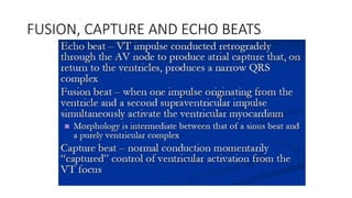 FUSION, CAPTURE AND ECHO BEATS
 