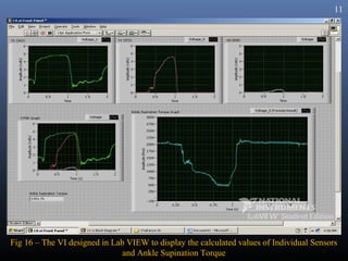 11




Fig 16 – The VI designed in Lab VIEW to display the calculated values of Individual Sensors
                               and Ankle Supination Torque
 