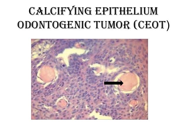 Final practical (( oralpatho )) for 3rd students 1-7-2013
