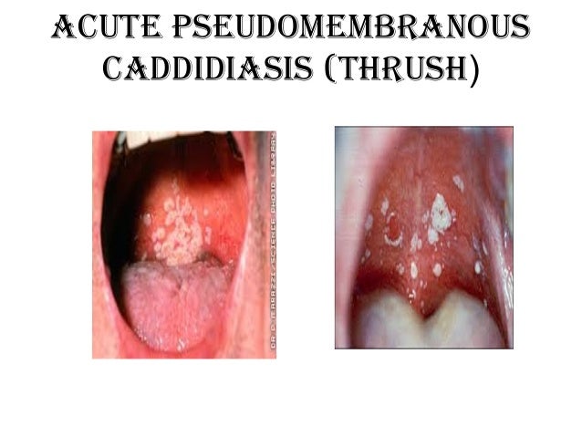 Final practical (( oralpatho )) for 3rd students 1-7-2013