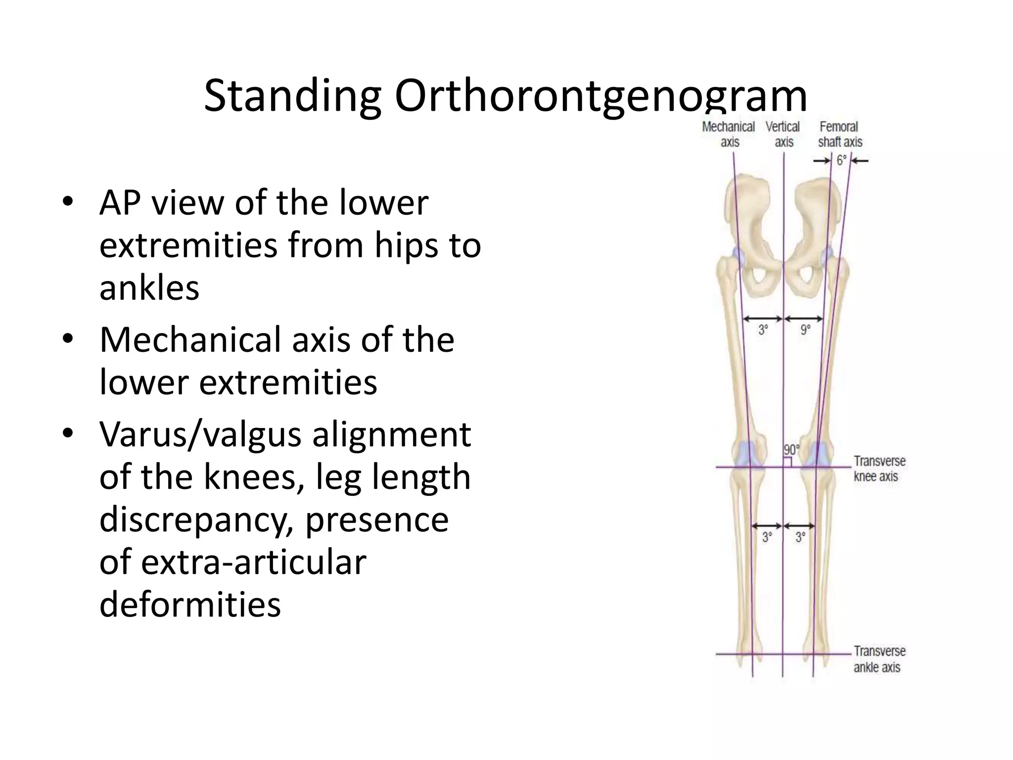 Standing Orthorontgenogram
• AP view of the lower
extremities from hips to
ankles
• Mechanical axis of the
lower extremities
• Varus/valgus alignment
of the knees, leg length
discrepancy, presence
of extra-articular
deformities
 