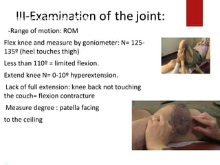 III-Examination of the joint:
3-Range of motion: ROM
F-Range of motion: ROM
Flex knee and measure by goniometer: N= 125-
135º (heel touches thigh)
Less than 110º = limited flexion.
Extend knee N= 0-10º hyperextension.
Lack of full extension: knee back not touching
the couch= flexion contracture
Measure degree : patella facing
to the ceiling lex knee and measure by
goniometer:
N= 125-135º (heel touches thigh)
Lessthan 110º = limited flexion.
 