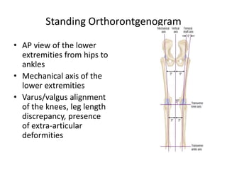 Standing Orthorontgenogram
• AP view of the lower
extremities from hips to
ankles
• Mechanical axis of the
lower extremities
• Varus/valgus alignment
of the knees, leg length
discrepancy, presence
of extra-articular
deformities
 