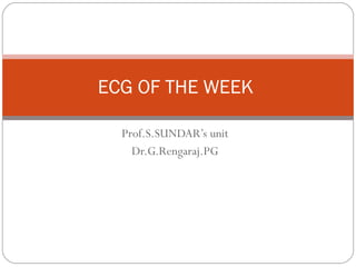 Prof.S.SUNDAR’s unit Dr.G.Rengaraj.PG ECG OF THE WEEK  