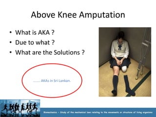 Above Knee Amputation
• What is AKA ?
• Due to what ?
• What are the Solutions ?


        ....... AKAs in Sri Lankan.
 