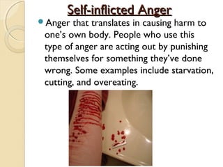 Self-inflicted Anger
Anger  that translates in causing harm to
 one’s own body. People who use this
 type of anger are acting out by punishing
 themselves for something they’ve done
 wrong. Some examples include starvation,
 cutting, and overeating.
 