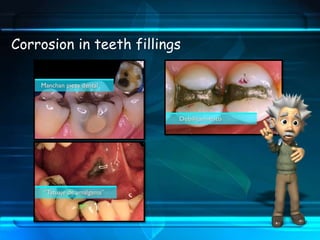 Corrosion in teeth fillings
 