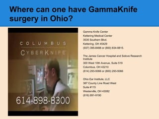 Where can one have GammaKnife
surgery in Ohio?
Gamma Knife Center
Kettering Medical Center
3535 Southern Blvd.
Kettering, ...