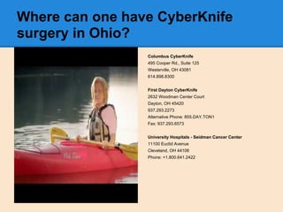 Where can one have CyberKnife
surgery in Ohio?
Columbus CyberKnife
495 Cooper Rd., Suite 125
Westerville, OH 43081
614.898...
