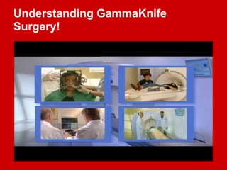Understanding GammaKnife
Surgery!
 