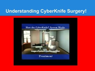 Understanding CyberKnife Surgery!
 