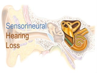 Sensorineural
Hearing
Loss
 