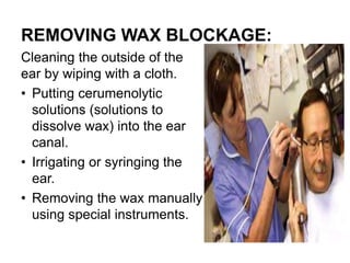 REMOVING WAX BLOCKAGE:
Cleaning the outside of the
ear by wiping with a cloth.
• Putting cerumenolytic
solutions (solutions to
dissolve wax) into the ear
canal.
• Irrigating or syringing the
ear.
• Removing the wax manually
using special instruments.
 