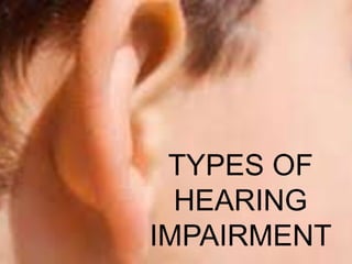 TYPES OF
HEARING
IMPAIRMENT
 