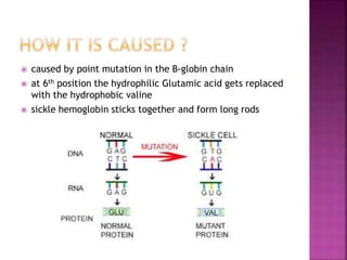  caused by point mutation in the B-globin chain
 at 6th position the hydrophilic Glutamic acid gets replaced
with the hydrophobic valine
 sickle hemoglobin sticks together and form long rods
 