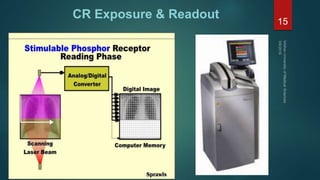 digital radiography | PPTX