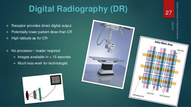 digital radiography