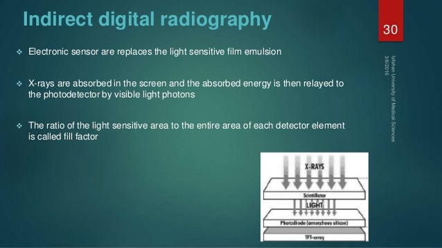 x number ray atomic radiography digital