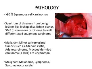 Carcinoma Buccal Mucosa- Anatomy to Management Slide 23