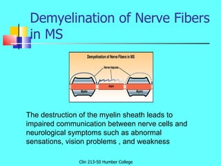 Demyelination of Nerve Fibers in MS Clin 213-50 Humber College The destruction of the myelin sheath leads to impaired comm...