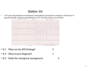 22
Station 1A:
• A 45 years old gentleman on maintenance haemodialysis presented to emergency with history of
generalized body weakness and palpitations, ECG was done which is given below.
• Q. 1 What are the ECG findings? 2
• Q. 2 What is your diagnosis? 1
• Q. 3 Enlist the emergency management. 2
 