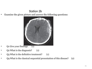 25
Station 2b
• Examine the given picture and answer the following questions:
• Q1 Give your findings. (1)
• Q2 What is the diagnosis? (1)
• Q3 What is the definitive treatment? (1)
• Q4 What is the classical sequential presentation of this disease? (2)
 