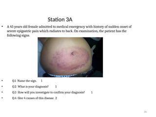 26
Station 3A
• A 45 years old female admitted to medical emergency with history of sudden onset of
severe epigastric pain which radiates to back. On examination, the patient has the
following signs.
• Q.1 Name the sign. 1
• Q.2 What is your diagnosis? 1
• Q.3 How will you investigate to confirm your diagnosis? 1
• Q.4 Give 4 causes of this disease. 2
 