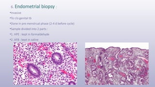 6. Endometrial biopsy :
•Invasive
•To r/o genital tb
•Done in pre menstrual phase (2-4 d before cycle)
•Sample divided into 2 parts :
•1. HPE : kept in formaldehyde
•2. AFB : kept in saline
 