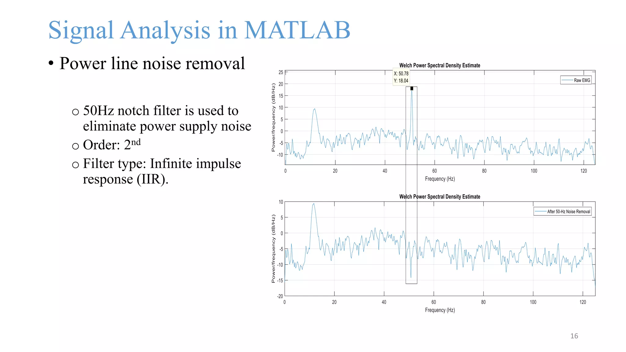 Signal Analysis in MATLAB
• Power line noise removal
o 50Hz notch filter is used to
eliminate power supply noise
o Order: 2nd
o Filter type: Infinite impulse
response (IIR).
16
 
