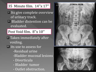  Its give complete overview
of urinary track.
 Bladder distention can be
evaluated.
 Taken immediately after
voiding.
 its use to assess for
-Residual urine
-Bladder mucosal lesions
- Diverticula
- Bladder tumor
- Outlet obstruction.
Post Void film. 8’’x 10’’
35 Minute film. 14’’x 17’’
35MIN FILM
 