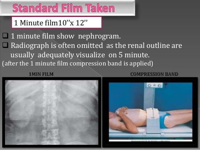 INTRAVENOUS UROGRAM