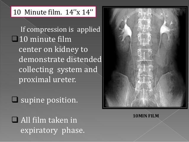 INTRAVENOUS UROGRAM